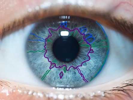 Macro Iris Eye Iridology